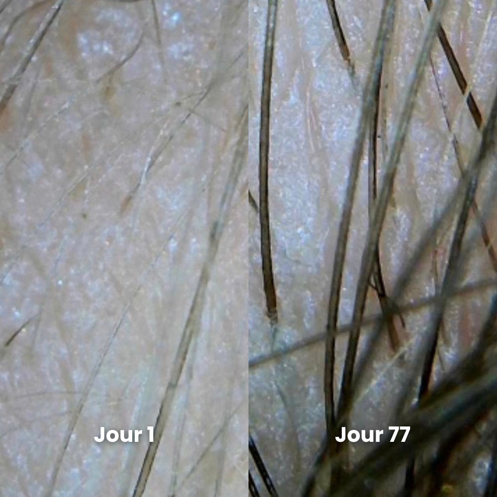 Cure nutrition complète - Renaisssance + Fortificateur